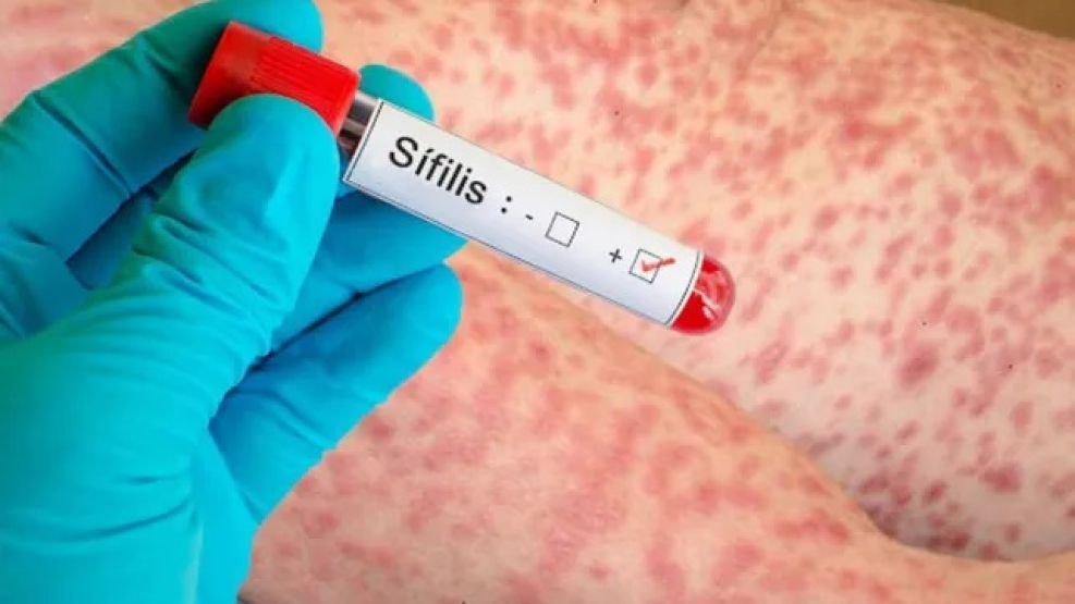 Imagen de Perfil de ETS